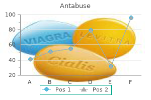 buy generic antabuse 250mg on line