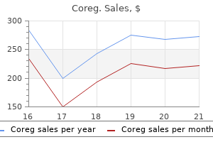 order coreg 25mg free shipping