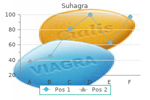 purchase 100 mg suhagra fast delivery